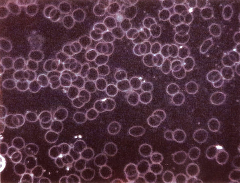 Clustered red blood cells under geopathic stress