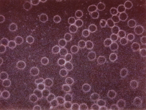 Unclustered free-moving red blood cells